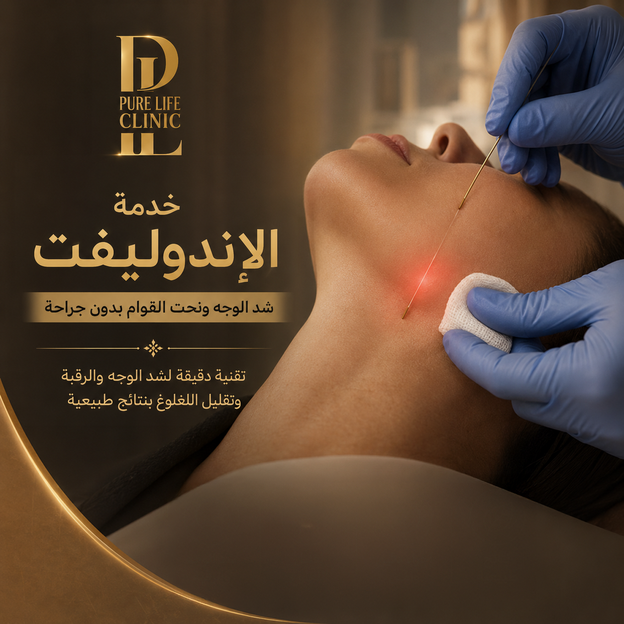 الاندوليفت (Endolift) شد الوجه ونحت القوام بدون جراحة